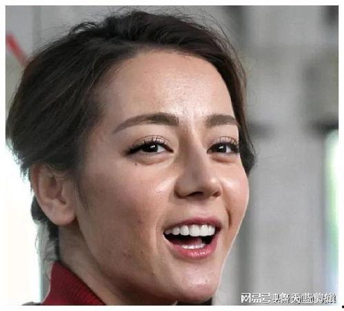 明星没有黑头,无瑕透亮,揭秘无黑头肌肤之道